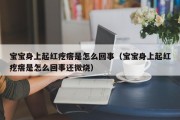 宝宝身上起红疙瘩是怎么回事(宝宝身上起红疙瘩是怎么回事还微烧) 宝宝身上起红疙瘩是怎么回事(宝宝身上起红疙瘩是怎么回事还微烧)